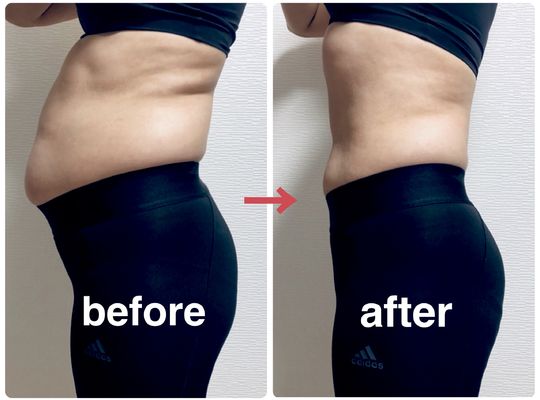 ビフォーアフター